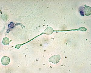マクロファージの細胞画像。