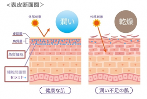 セラミドがある角質層を含む、表皮の断面図を表しています