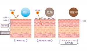 健康な肌と乾燥、角質肥厚の肌の断面を比較しています