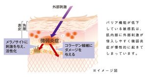 肌内部の炎症はコラーゲンを壊す