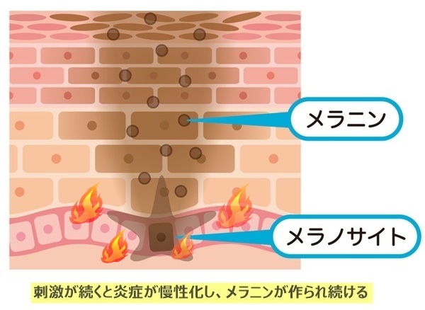 刺激が続くとメラニンが作られ続ける