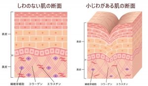 小じわがない肌とある肌の断面図