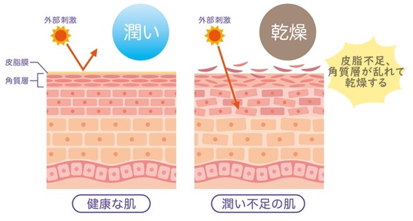 正常な肌と乾燥肌の断面図